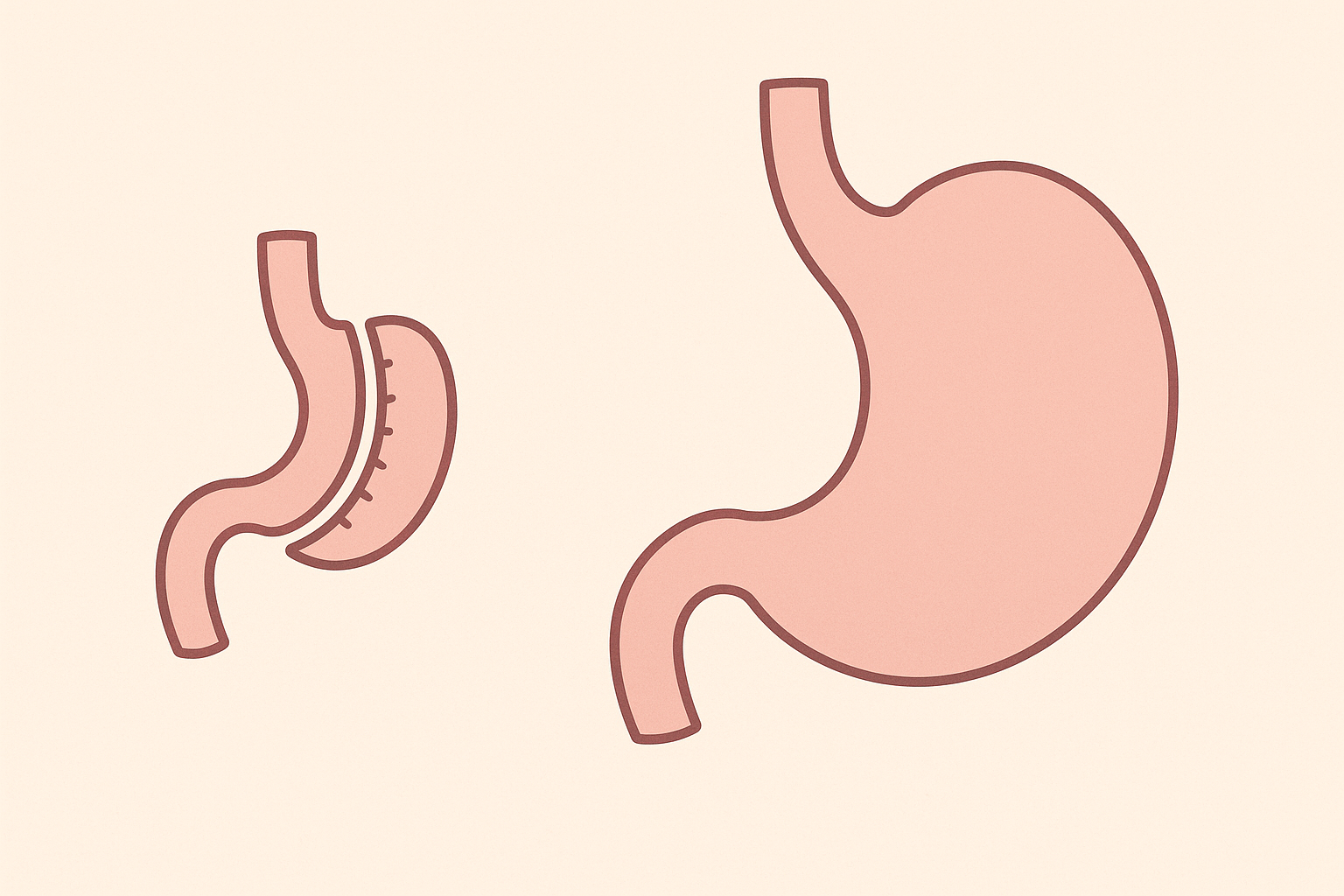 Gastric sleeve meal plan guide